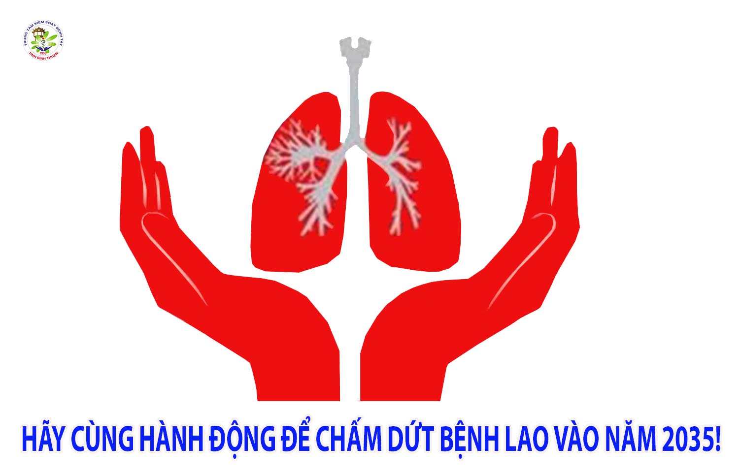 ĐÚNG! CHÚNG TA CÓ THỂ CHẤM DỨT BỆNH LAO! 