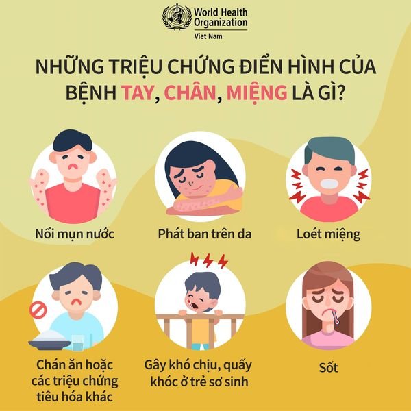 BÊNH TAY CHÂN MIỆNG: LƯU Ý CÁC DẤU HIỆU NGUY HIỂM 