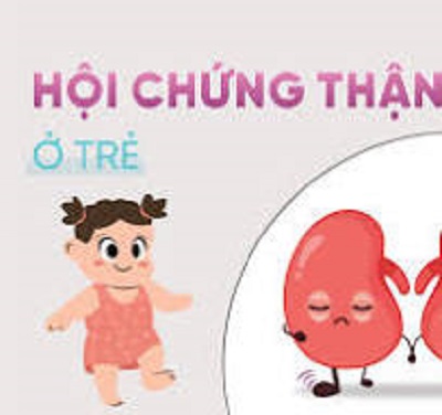 Những điều cần biết về hội chứng thận hư ở trẻ em