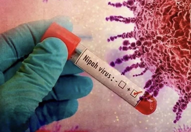 Bộ Y tế khuyến cáo phòng bệnh Nipah