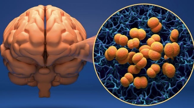 Chủ động các biện pháp phòng bệnh do não mô cầu