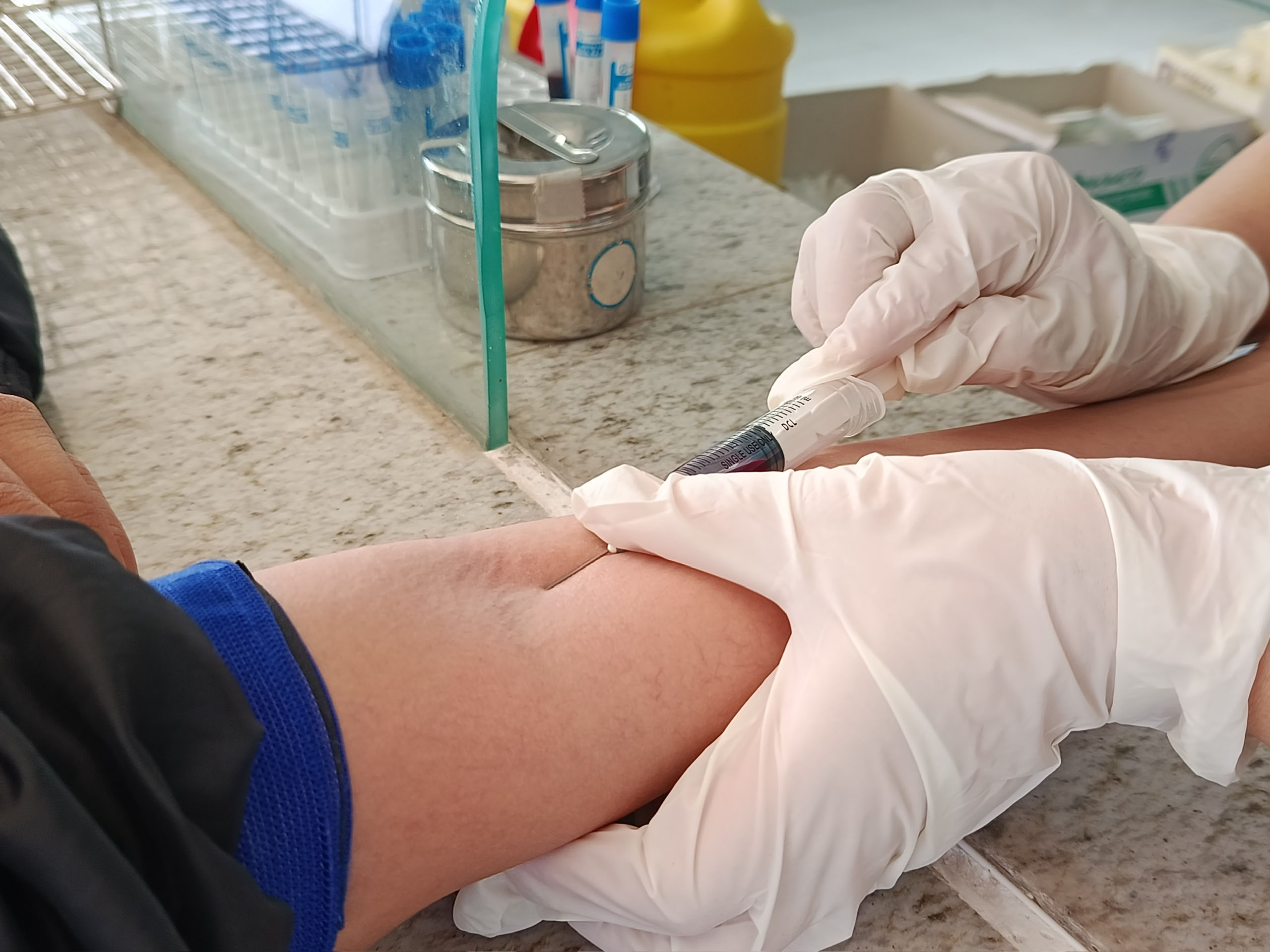 Cà Mau mở rộng điều trị dự phòng trước phơi nhiễm HIV bằng PrEP