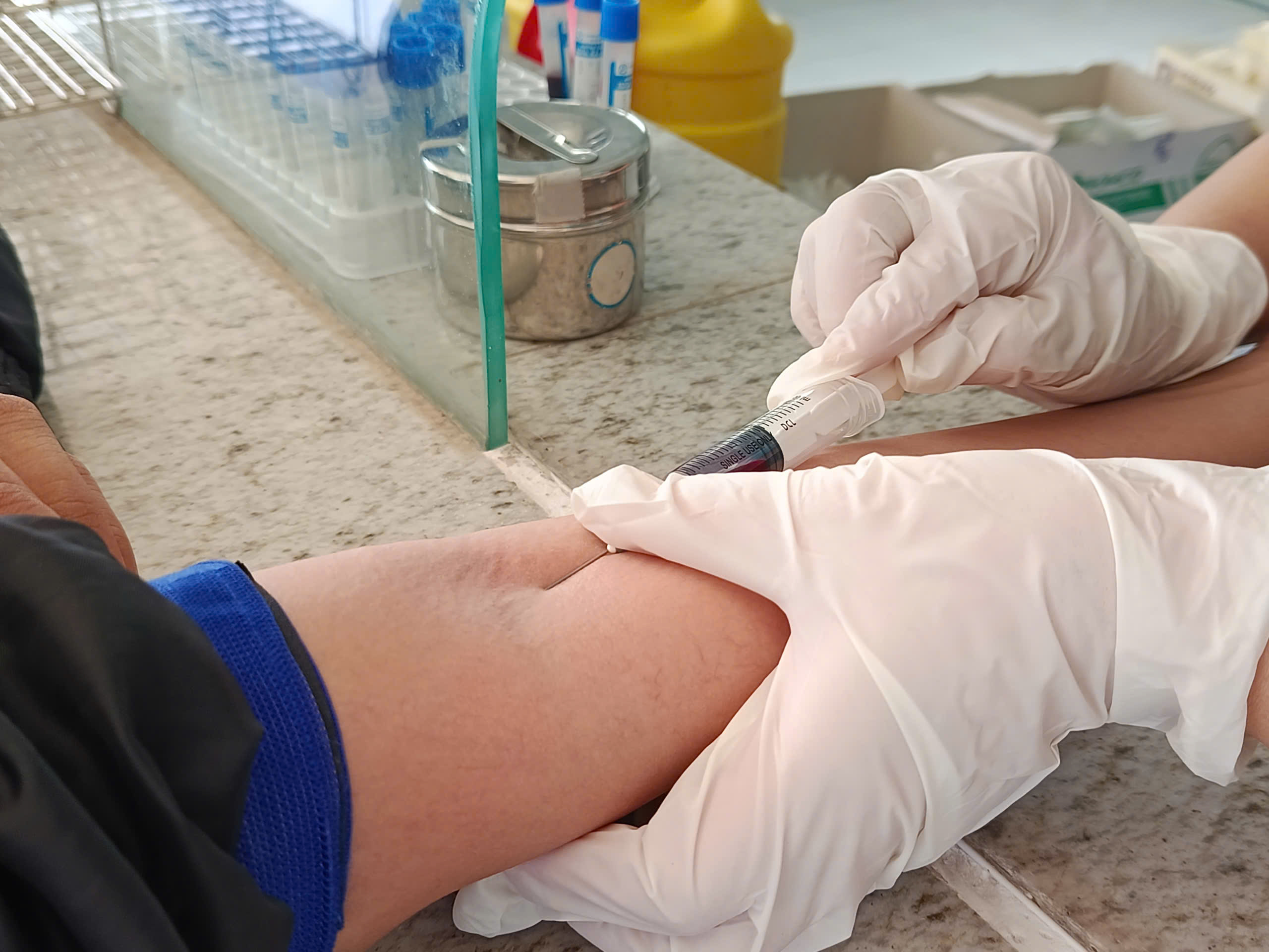 Dự phòng trước phơi nhiễm HIV (PrEP): Giải pháp chủ động, an toàn và hiệu quả