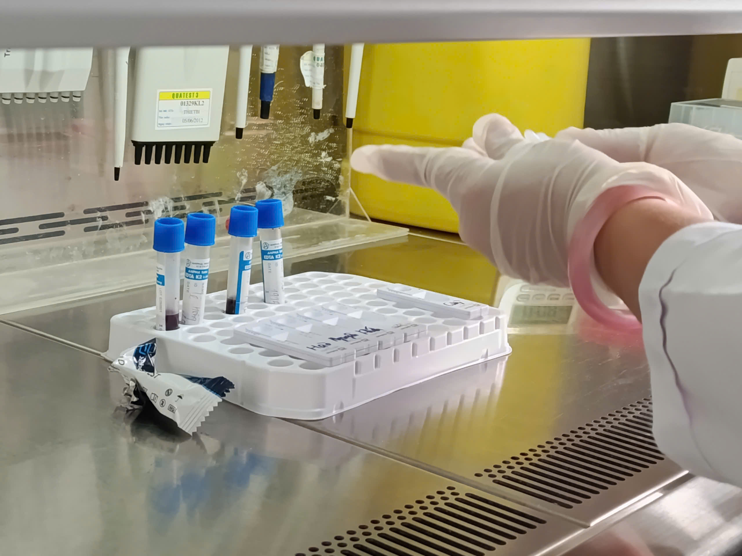Tương lai của PrEP tại Cà Mau: Giữ vững thành quả, chủ động nguồn lực địa phương