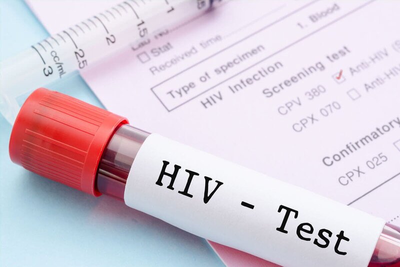 “Xét nghiệm HIV online” – Cánh cửa mới giúp người nguy cơ cao tiếp cận y tế an toàn, kín đáo
