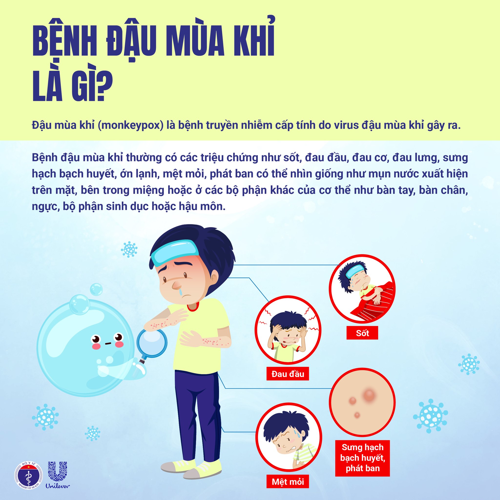 Không chủ quan với bệnh Đậu mùa khỉ