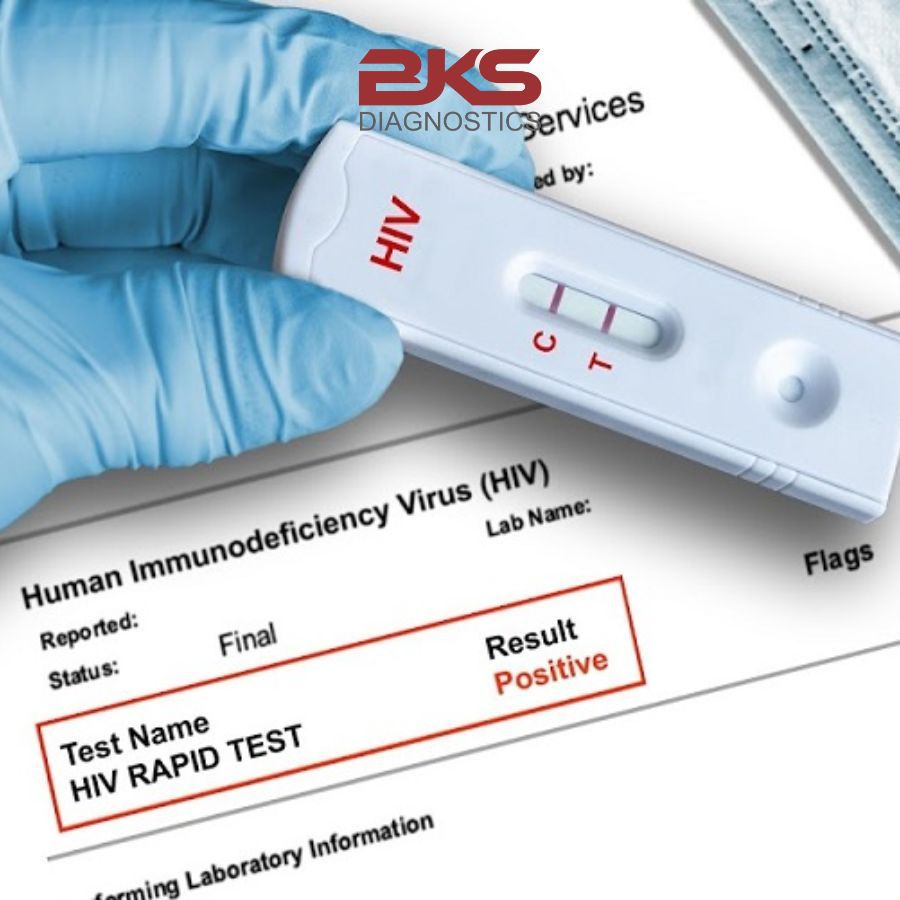 Ngại đến cơ sở y tế, nhiều người chọn xét nghiệm HIV online