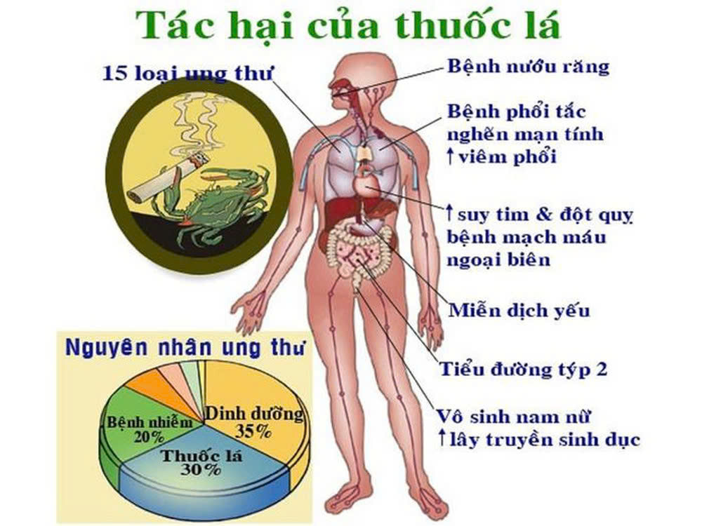 5 thói quen xấu làm gia tăng nguy cơ ung thư