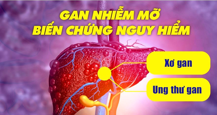 bien-chung-gan-nhiem-mo.jpg