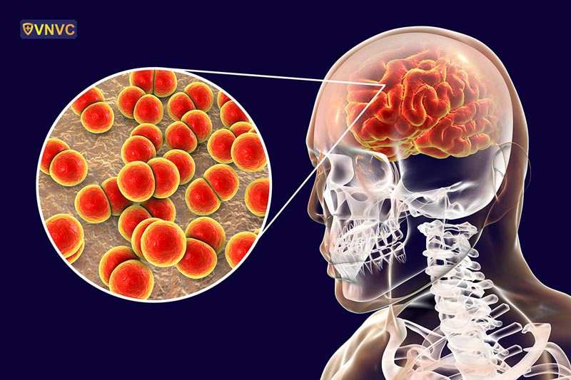 BÀI TUYÊN TRUYỀN PHÒNG BỆNH VIÊM NÃO MÔ CẦU