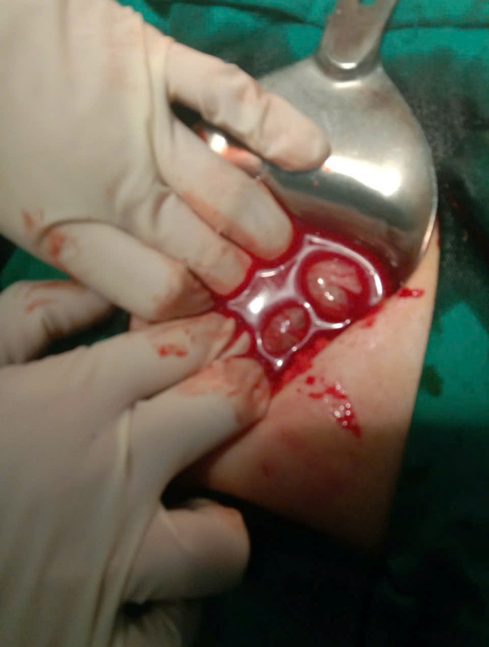 C:\Users\book 1\Documents\BỆNH VIỆN\BÀI VIẾT ĐĂNG TẢI\ẢNH\z6930357426495_5e8f37c231a432aa8f2b982c94eb08d6.jpg