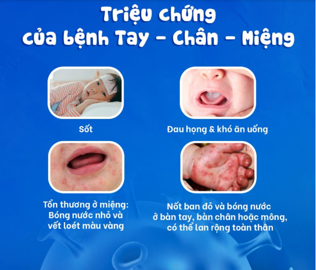 Phòng, chống bệnh tay chân miệng