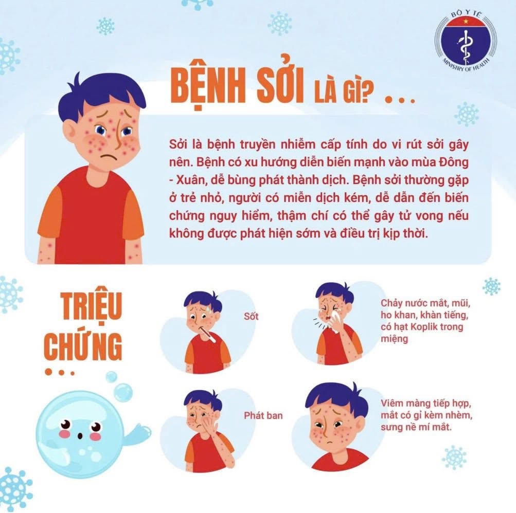 DẤU HIỆU NHẬN BIẾT BỆNH SỞI VÀ CÁCH XỬ TRÍ KỊP THỜI
