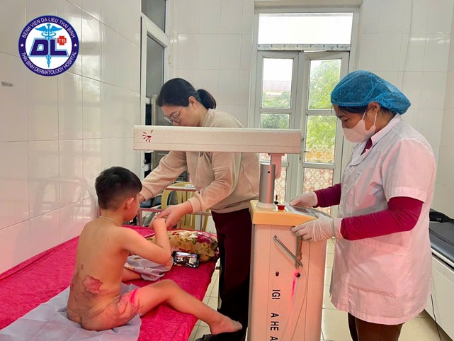 Cảnh giác với tai nạn bỏng ở trẻ nhỏ trong dịp Tết Nguyên đán Bính Ngọ 2026